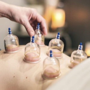 Cupping Therapy