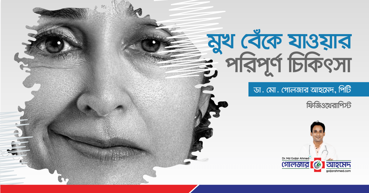 You are currently viewing মুখ বেঁকে যাওয়া রোগীর পরিপূর্ণ চিকিৎসা