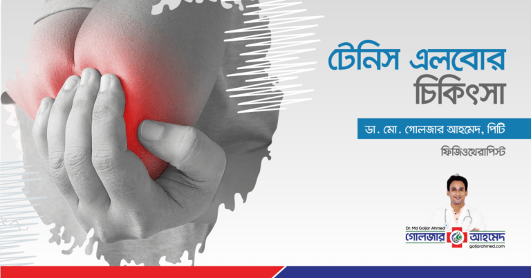 Read more about the article কনুই ব্যথা বা টেনিস এলবোর চিকিৎসা