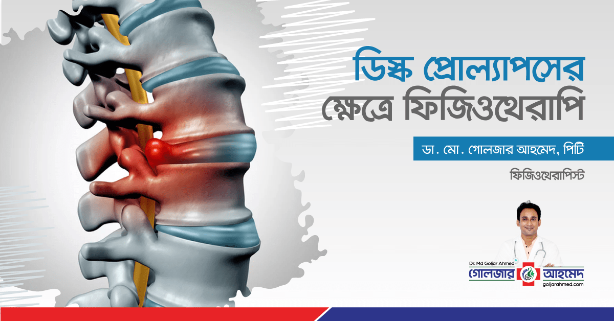 You are currently viewing ডিস্ক প্রোল্যাপস এর ক্ষেত্রে ফিজিওথেরাপির ভূমিকা