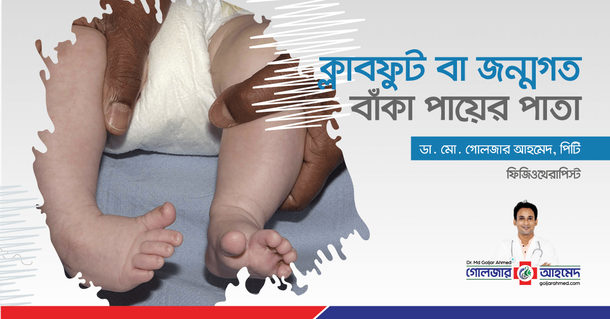 You are currently viewing ক্লাবফুট বা জন্মগত বাঁকা পায়ের পাতা