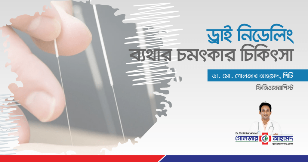 ড্রাই নিডেলিং