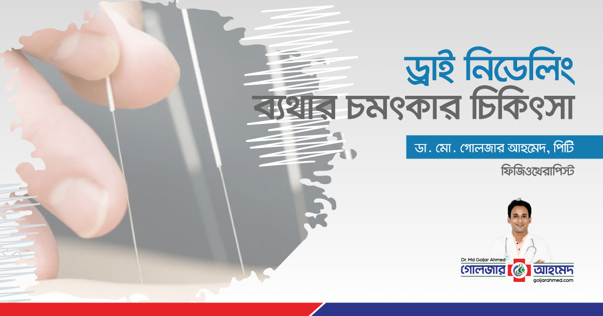 You are currently viewing ড্রাই নিডেলিং-ব্যথার চমৎকার চিকিৎসা